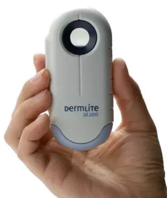 dermatoscopio