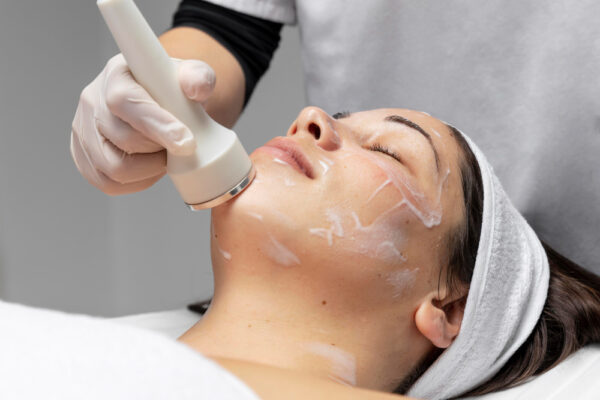 radiofrecuancia-facial
